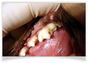 う歯（虫歯）の治療