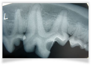 う歯（虫歯）の治療
