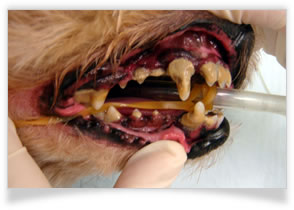 歯周病（歯槽膿漏）の治療
