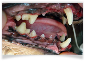 歯周病（歯槽膿漏）の治療