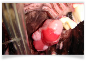 腫瘍の治療：上顎に発生した腫瘍です。