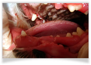 歯肉過形成症の治療