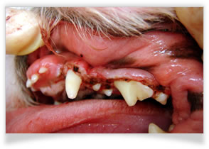 歯肉過形成症の治療